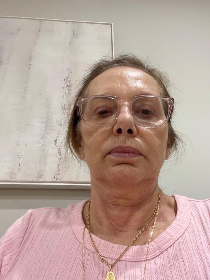 Depois — Resultado real