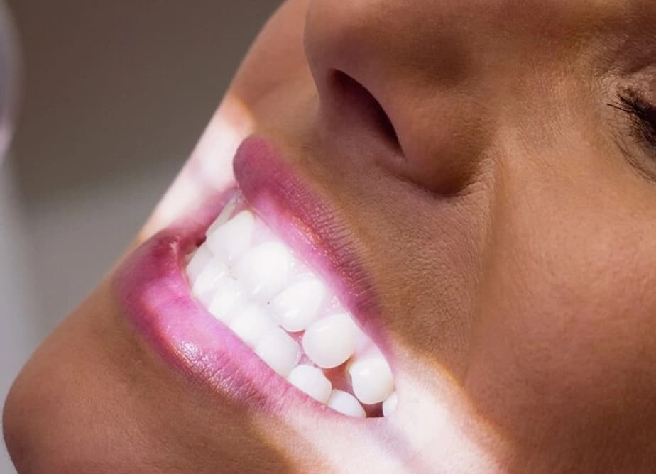 Depois — Resultado real